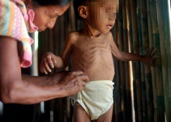 Guatemala lidera el hambre en Centroamérica y el 44,6% de sus niños sufre desnutrición crónica