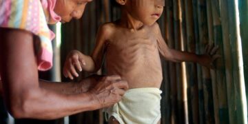 Guatemala lidera el hambre en Centroamérica y el 44,6% de sus niños sufre desnutrición crónica