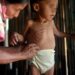 Guatemala lidera el hambre en Centroamérica y el 44,6% de sus niños sufre desnutrición crónica